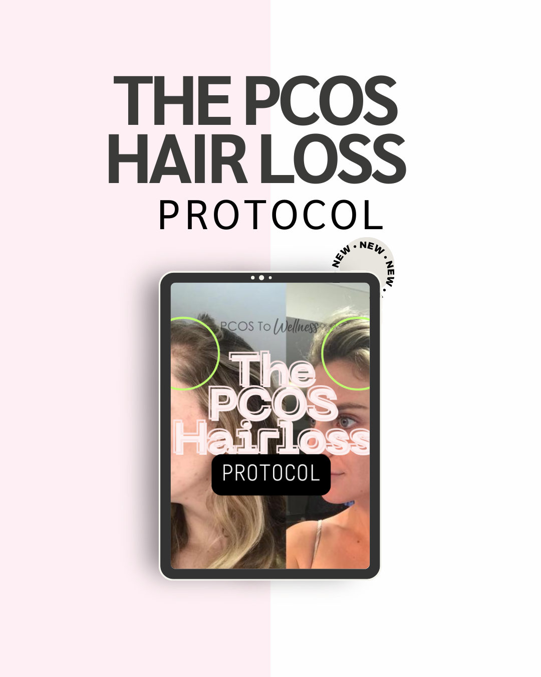 PCOS HAIR LOSS PROTOCOL