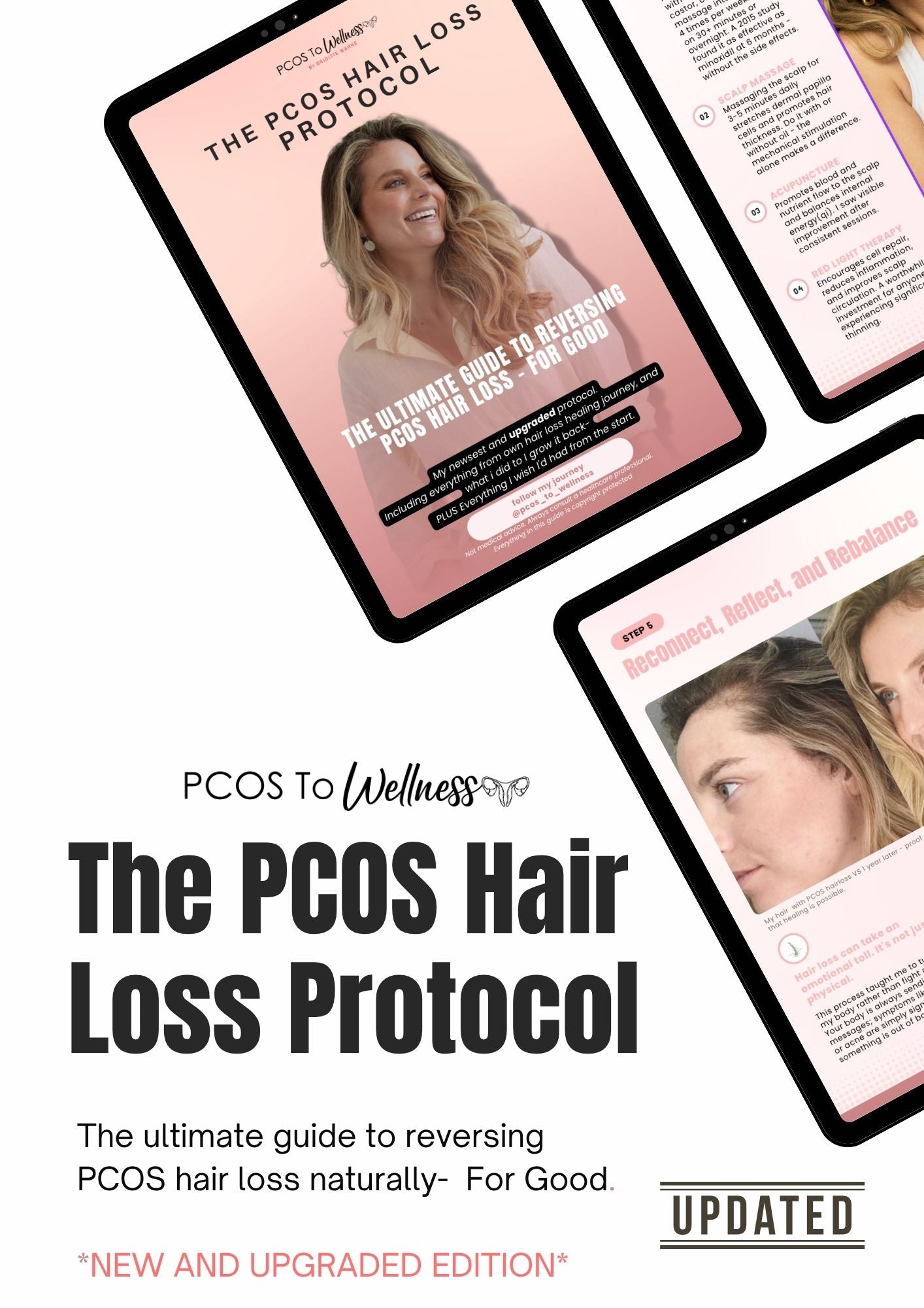 THE PCOS HAIR LOSS PROTOCOL *UPGRADED*